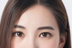 盐城开眼角手术会留下疤痕吗