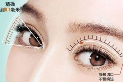 盐城开内眼角会出现疤痕增生吗？