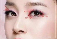 盐城切开双眼皮术后如何快速消肿呢？